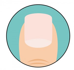 test1