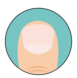 test2