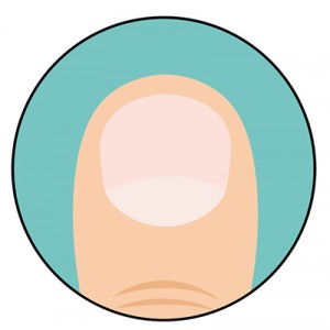 test3
