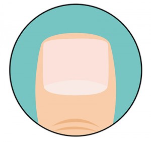 test5-1