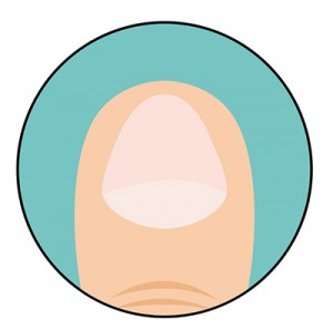 test6
