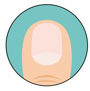 test7