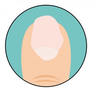 test8